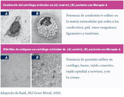 genetics_and_pathophysiology